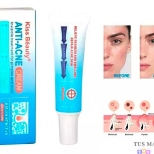Crema anti acne Kiss beauty