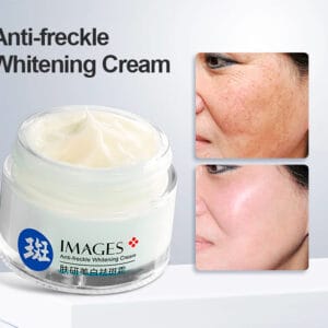 Crema blanqueadora de pecas y manchas images